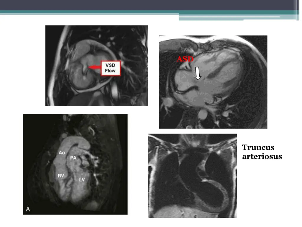 slide14