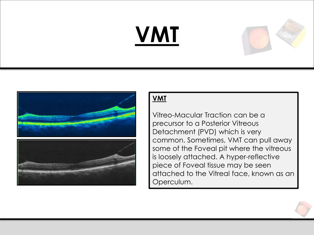 slide12
