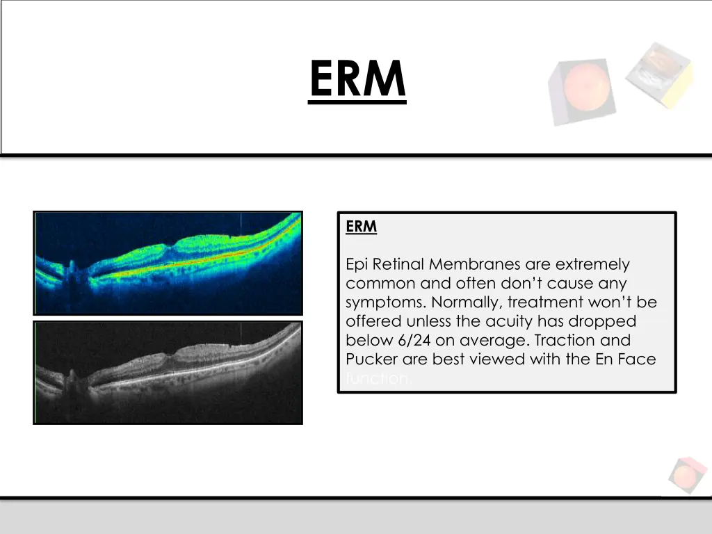 slide9