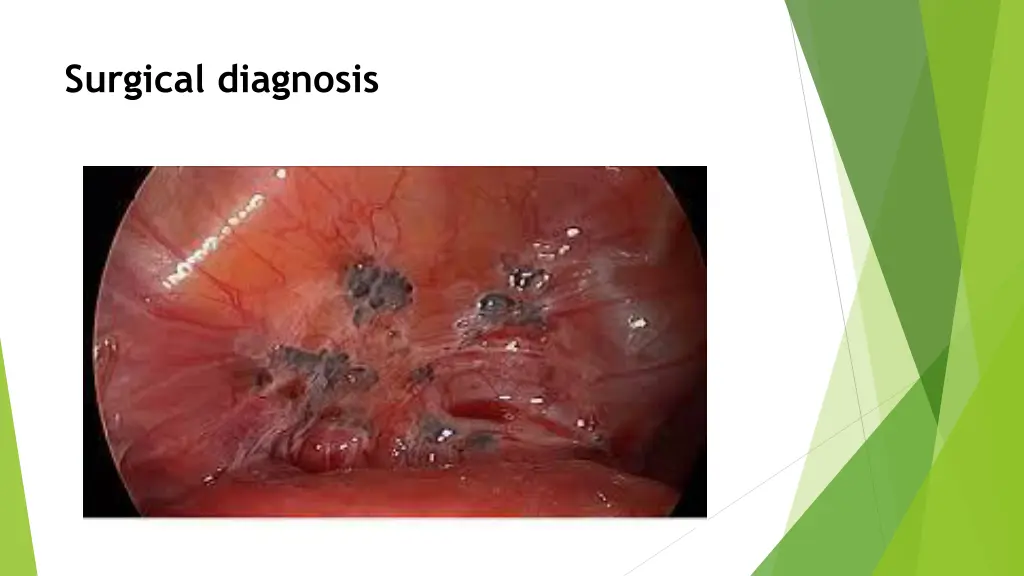 surgical diagnosis