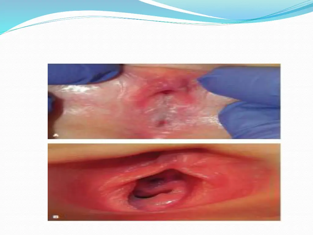 slide5