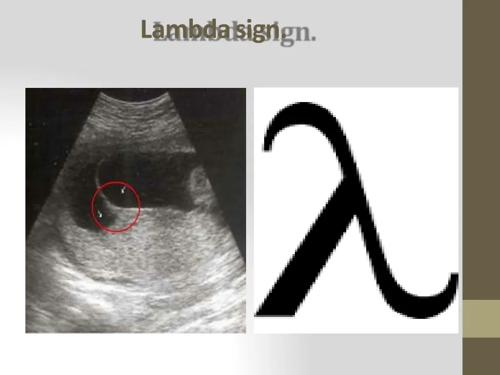 lambda sign