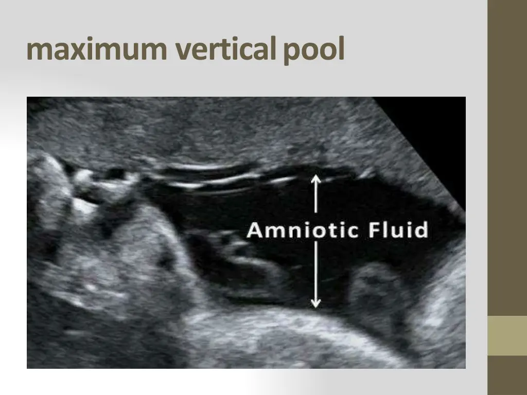 maximum vertical pool