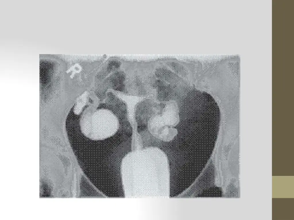 slide34