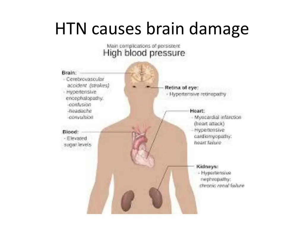 htn causes brain damage 1