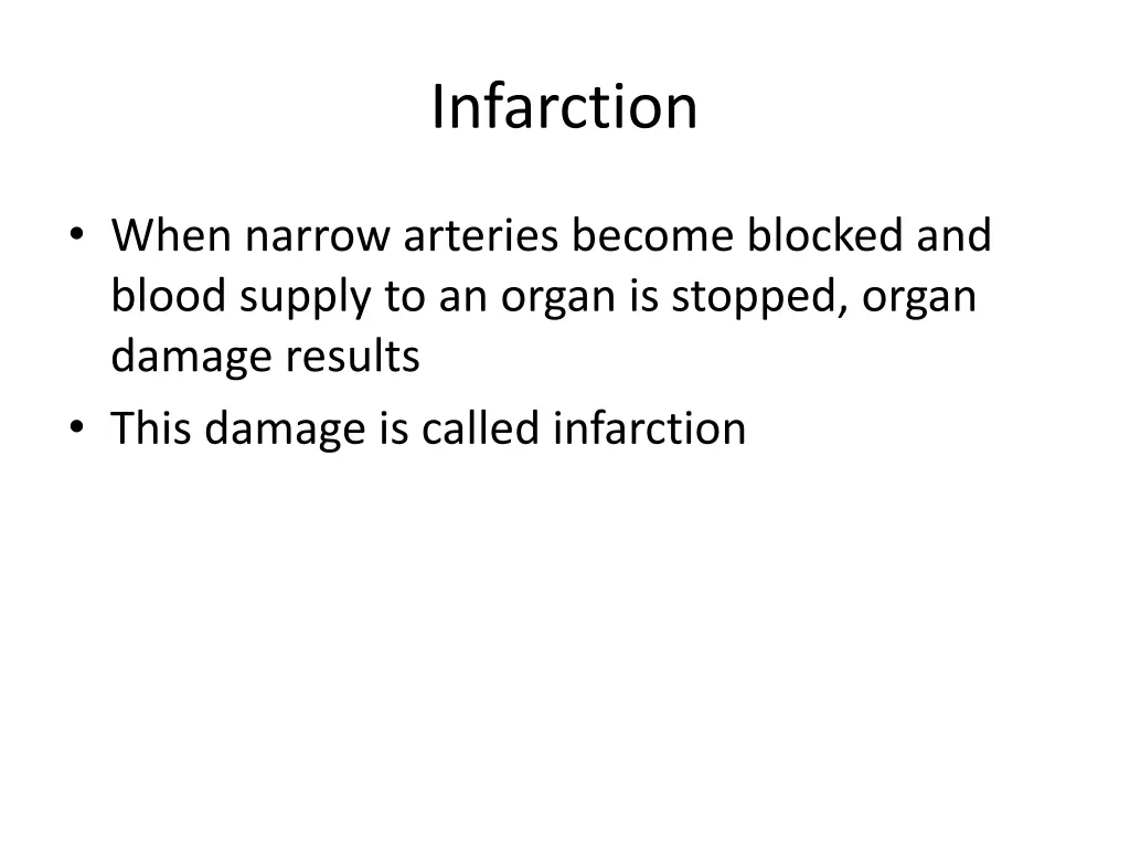 infarction
