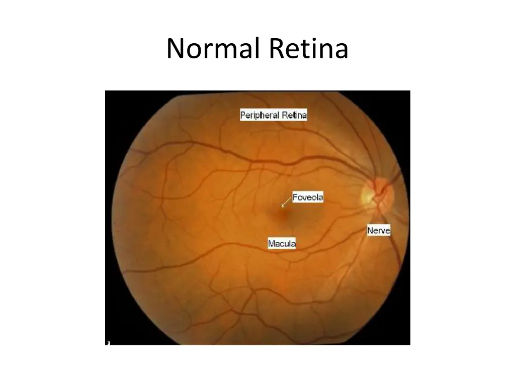 normal retina