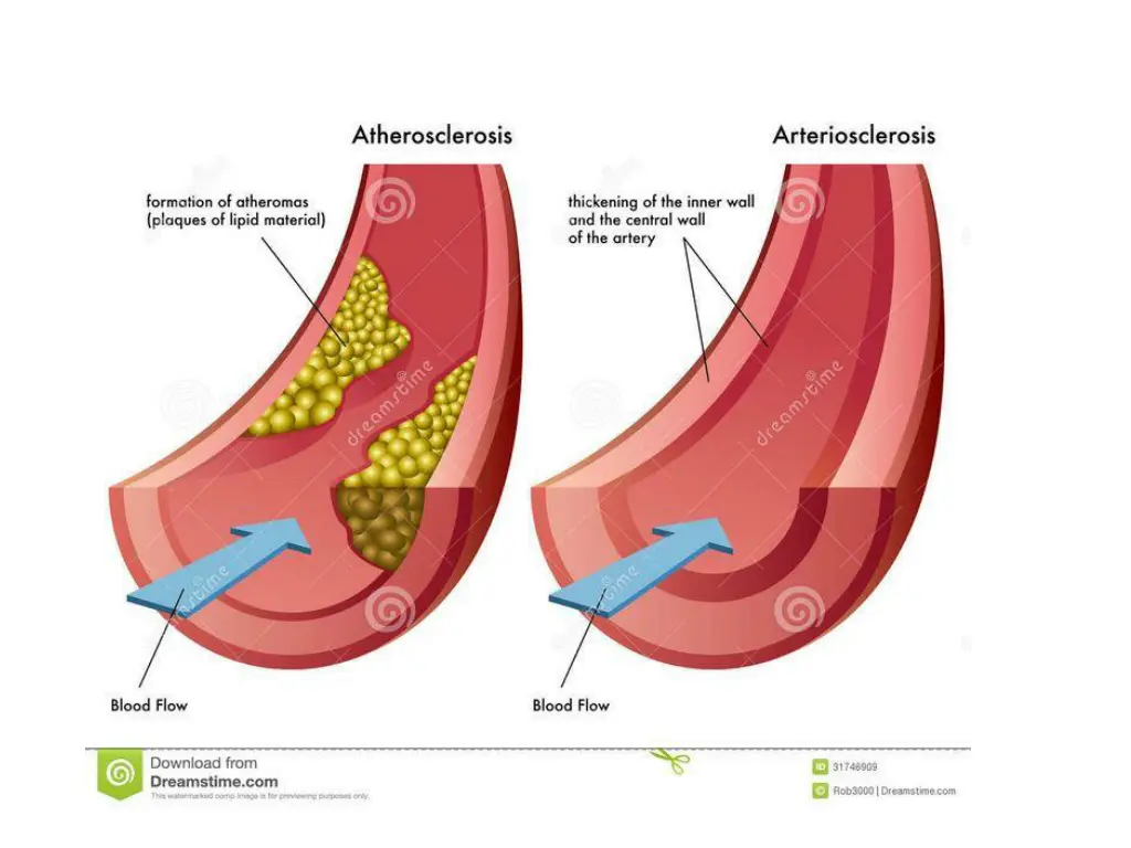 slide23