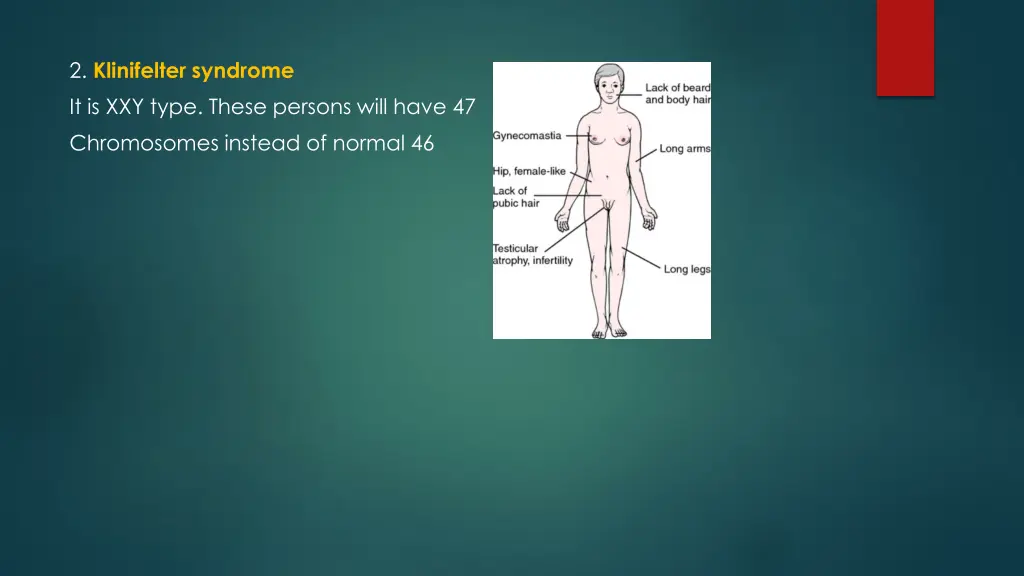 2 klinifelter syndrome it is xxy type these
