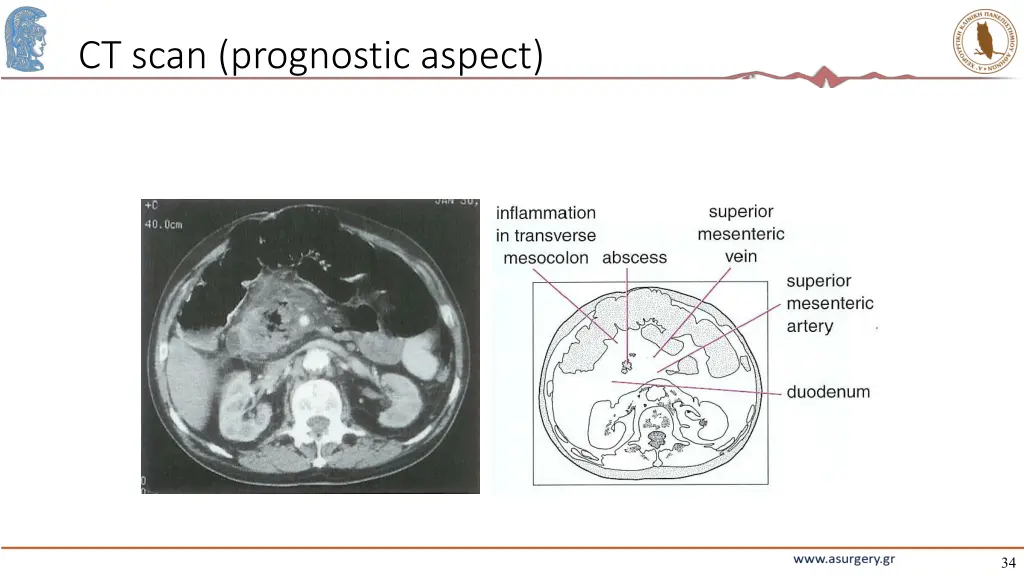 ct scan prognostic aspect 2