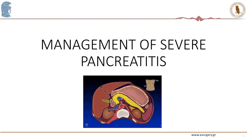 management of severe pancreatitis