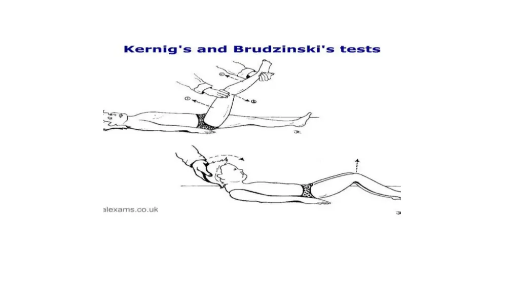 slide7