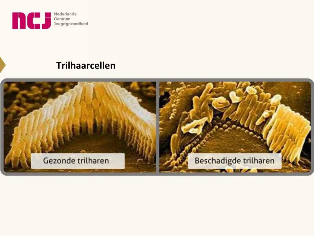 trilhaarcellen