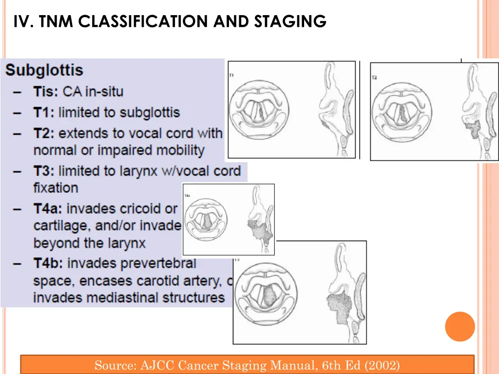 iv tnm classification and staging