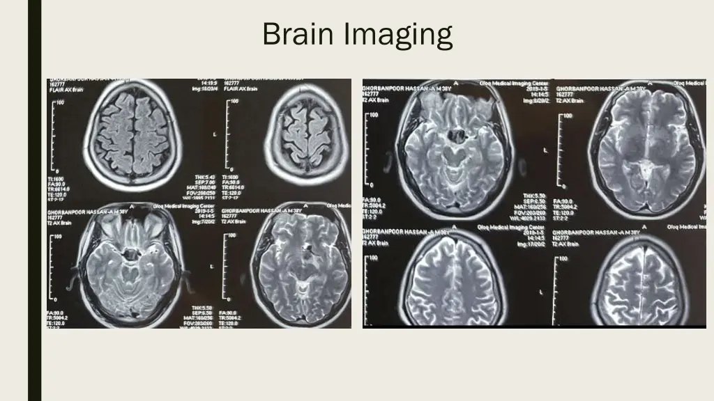 brain imaging 1