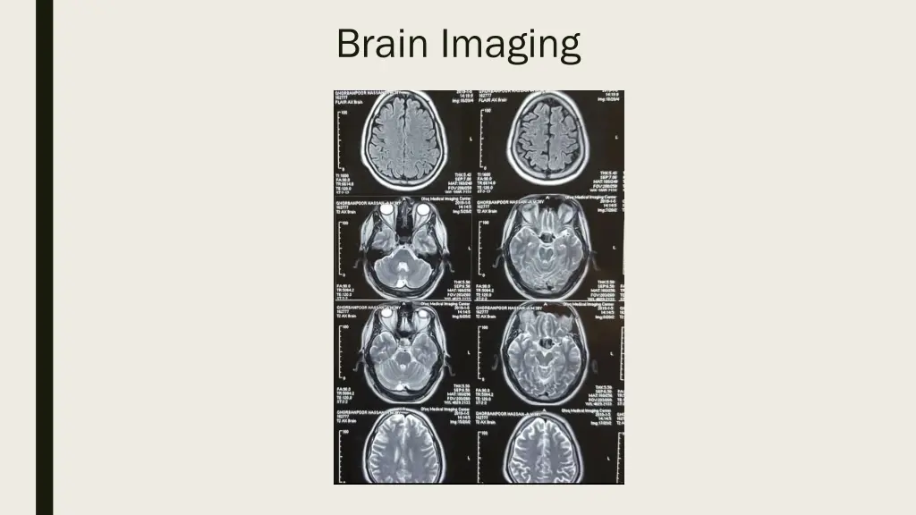 brain imaging 2
