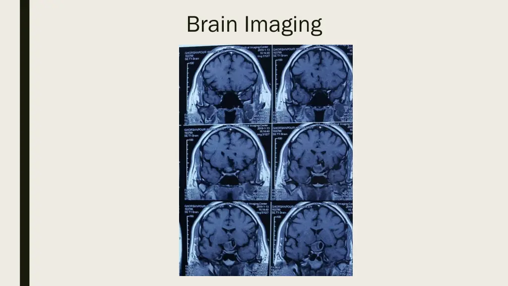 brain imaging 3