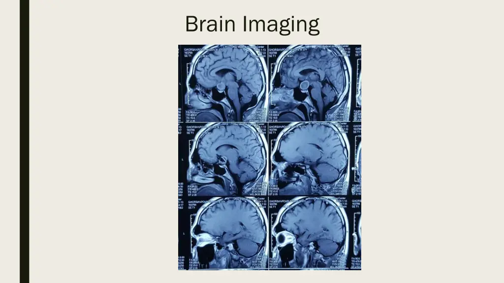 brain imaging