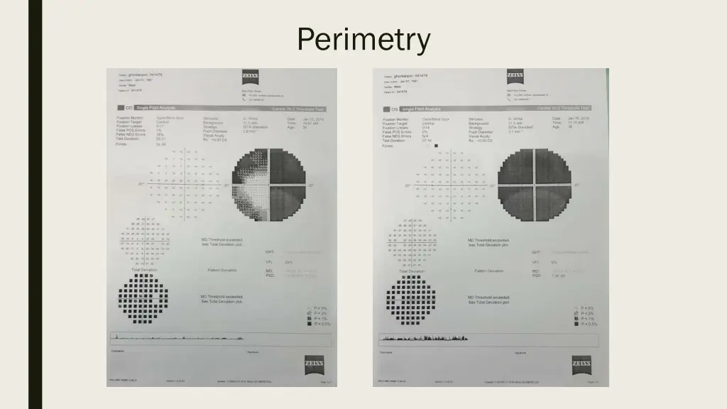 perimetry