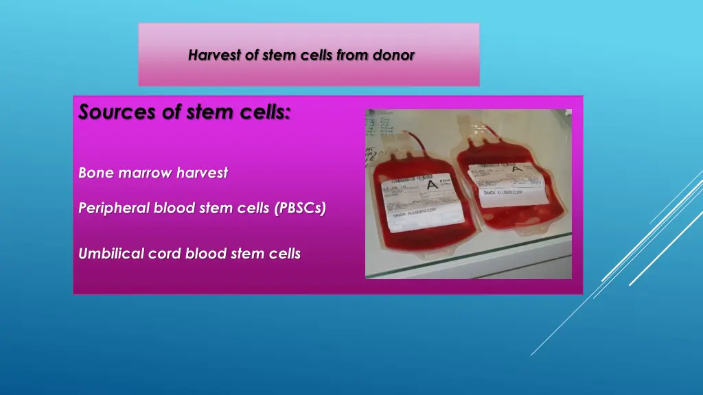 harvest of stem cells from donor