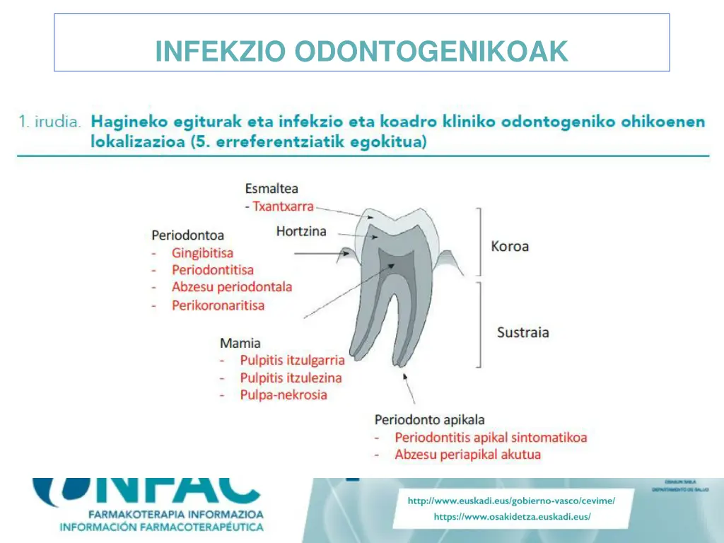 infekzio odontogenikoak 1