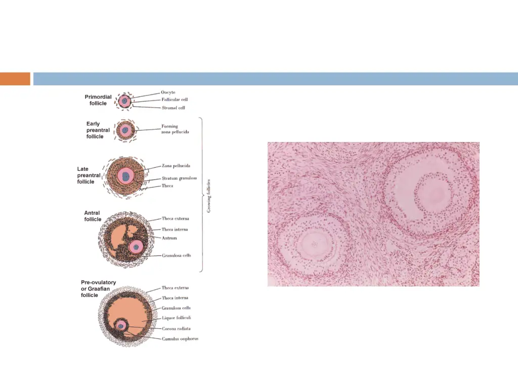 slide11