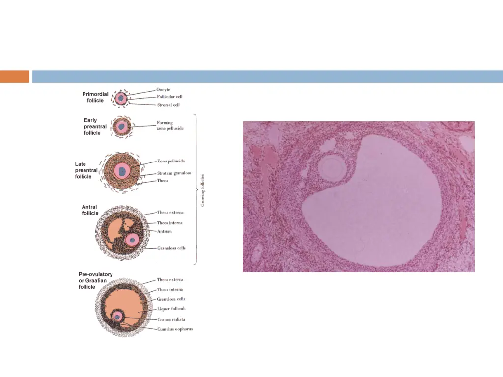 slide13