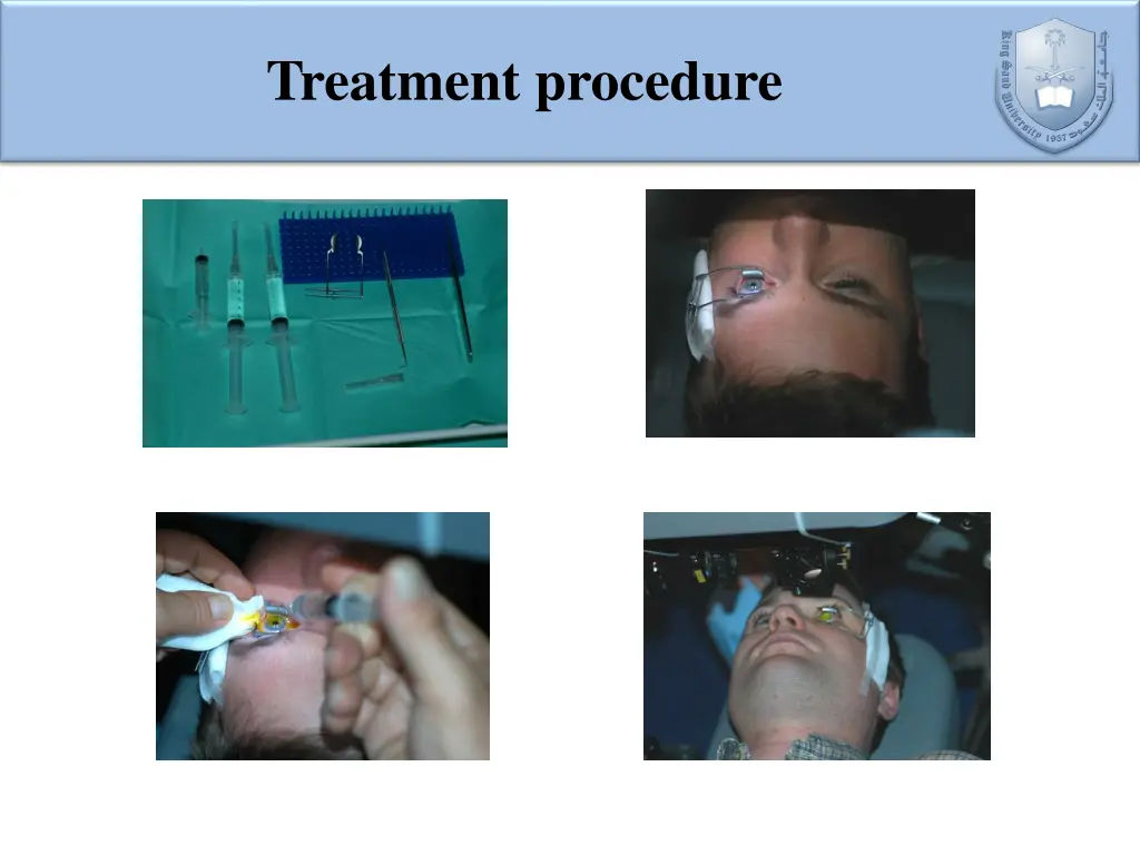 treatment procedure