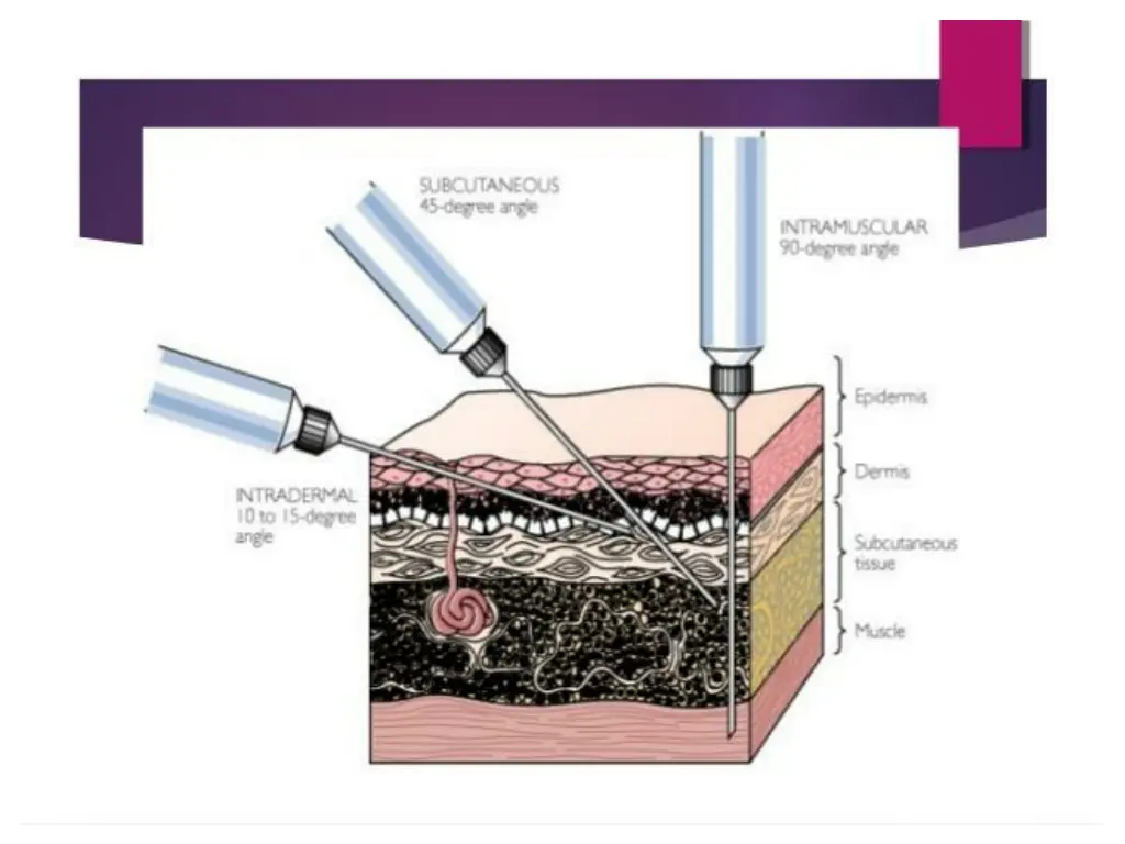 slide11