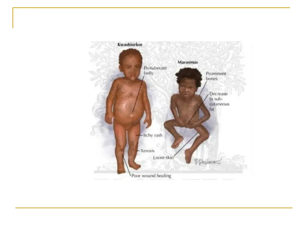 slide13