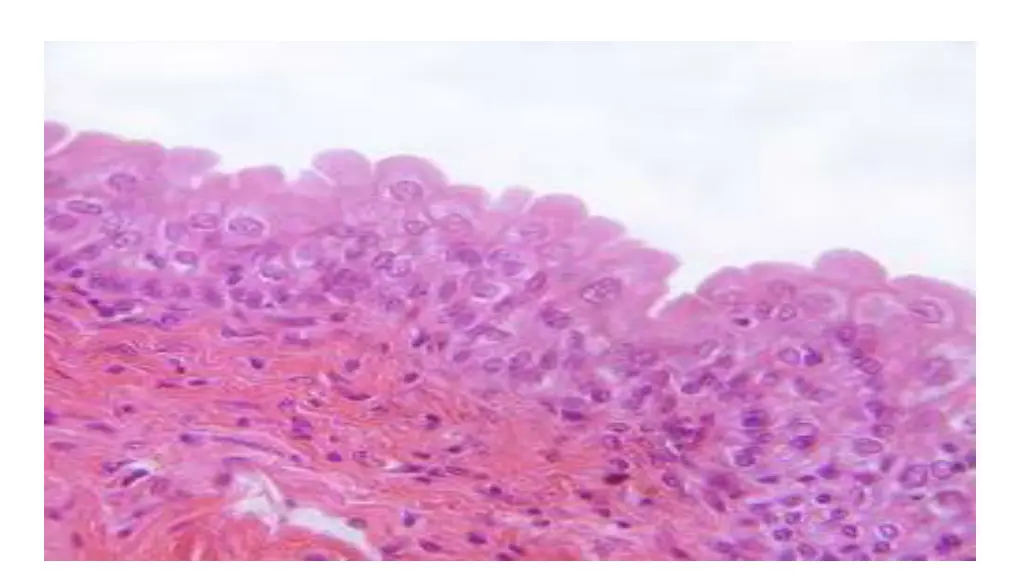slide14