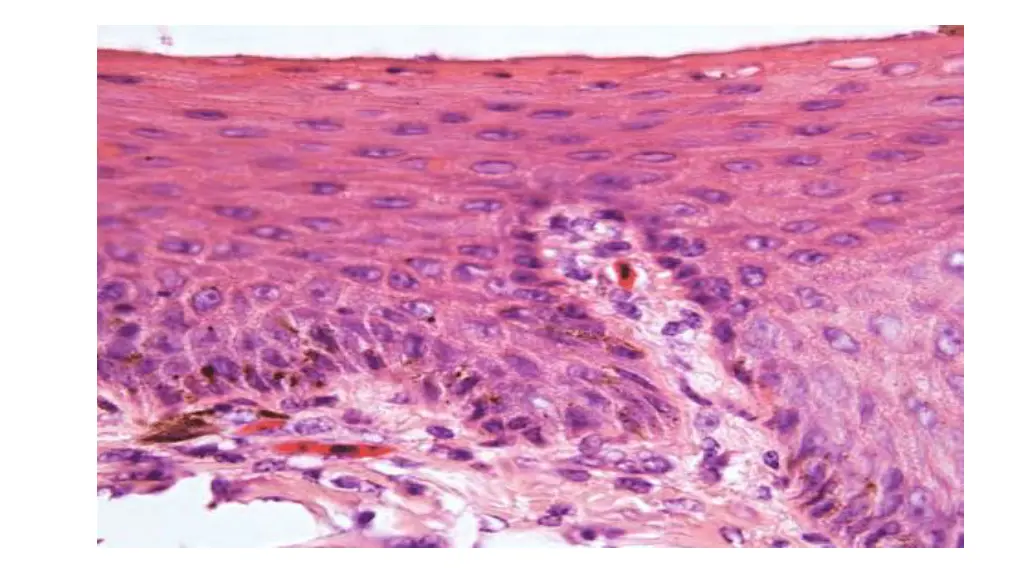 slide6