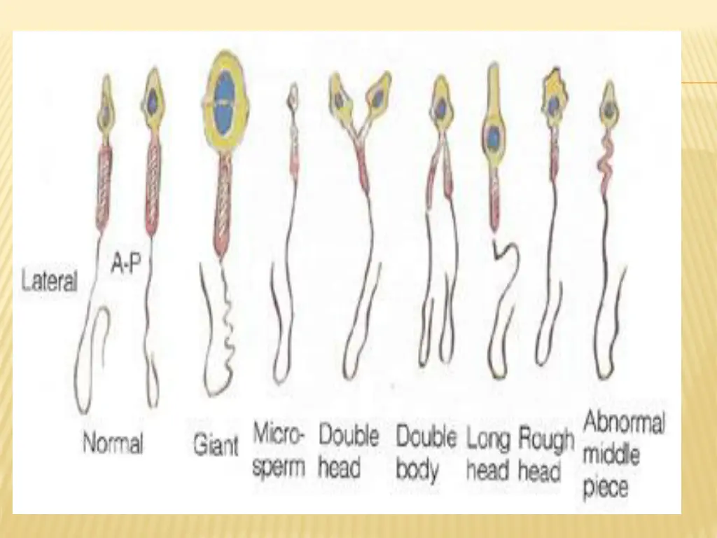 slide26