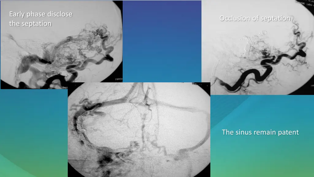 early phase disclose the septation