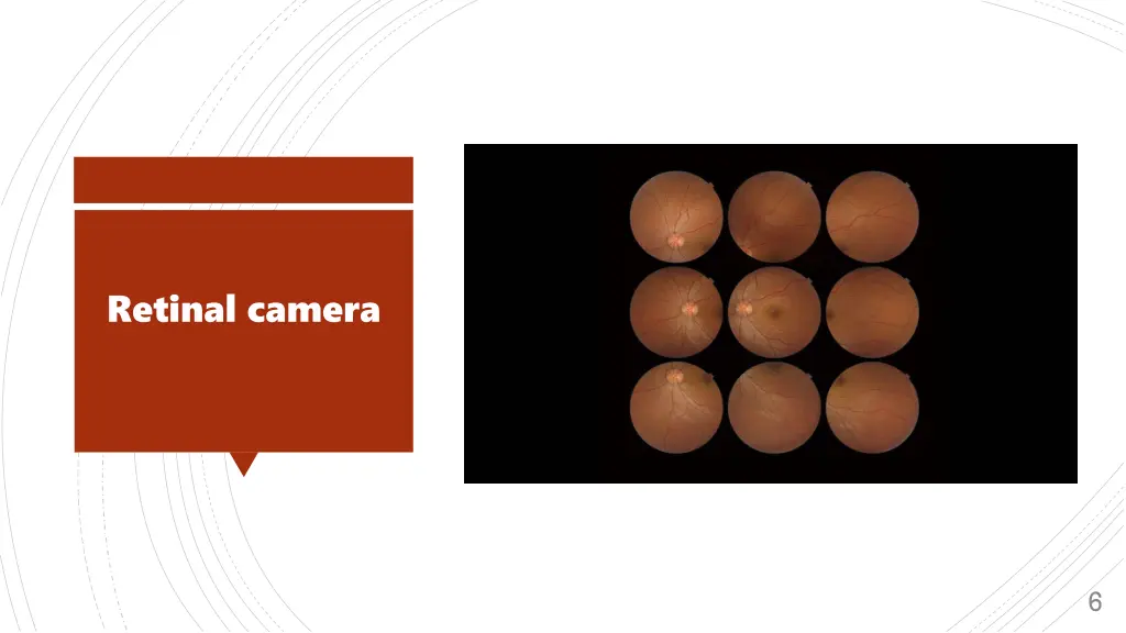 retinal camera