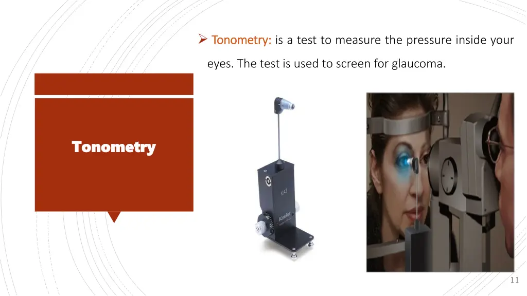 tonometry tonometry is a test to measure
