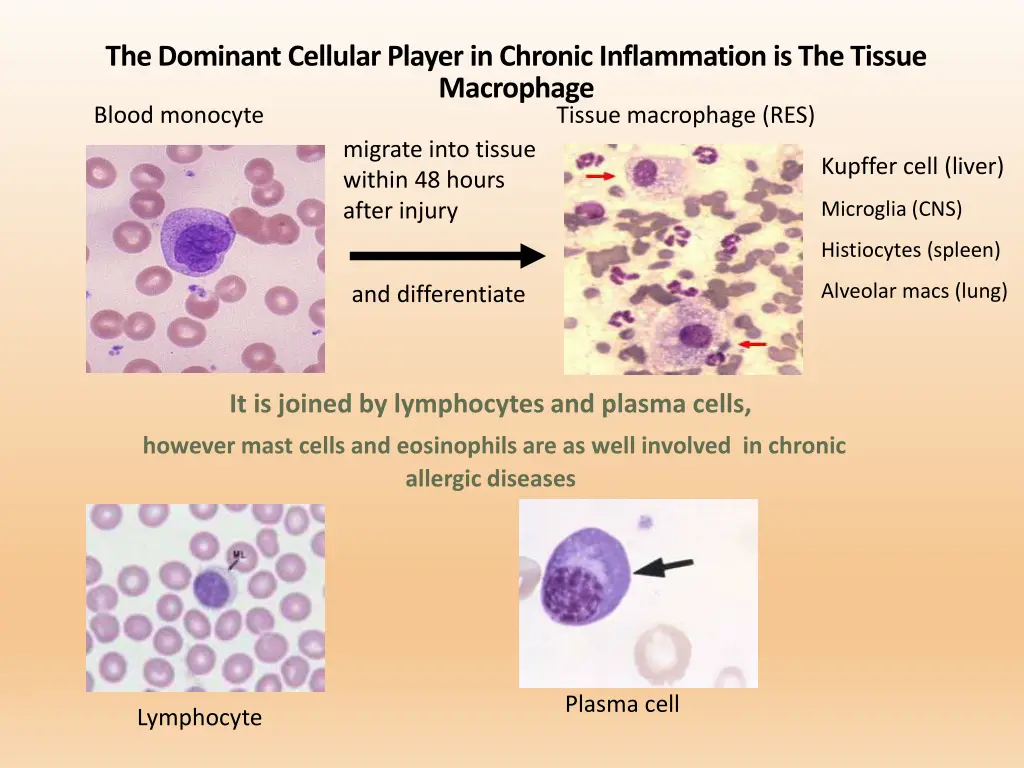 the dominant cellular player in chronic