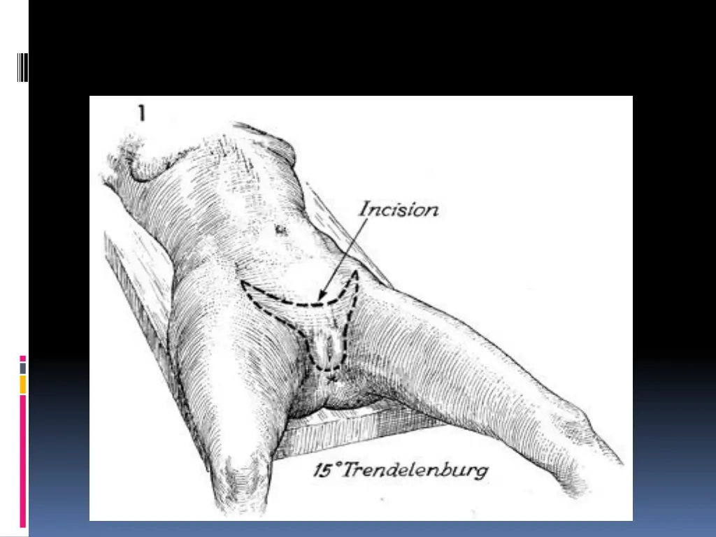 slide14
