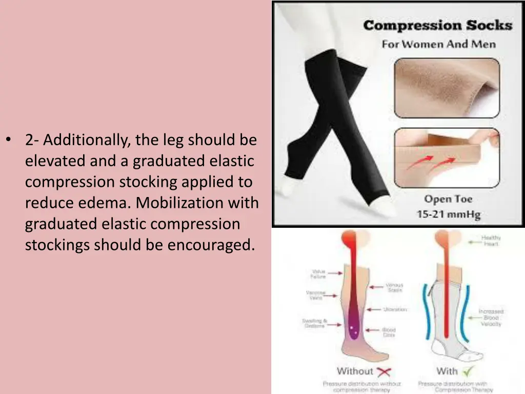 2 additionally the leg should be elevated