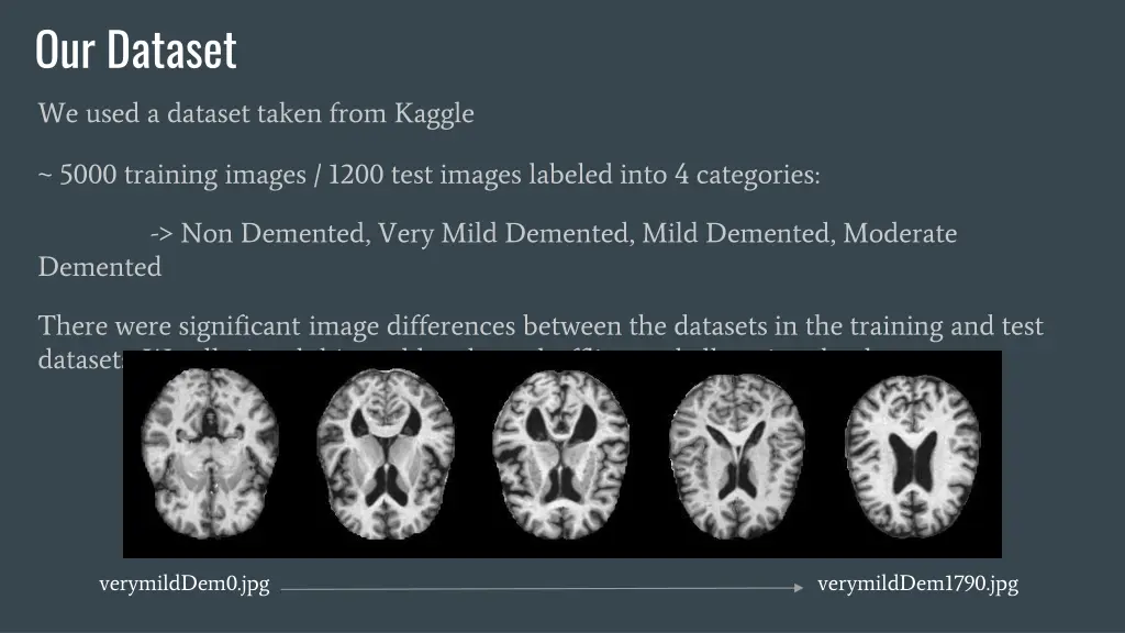 our dataset we used a dataset taken from kaggle