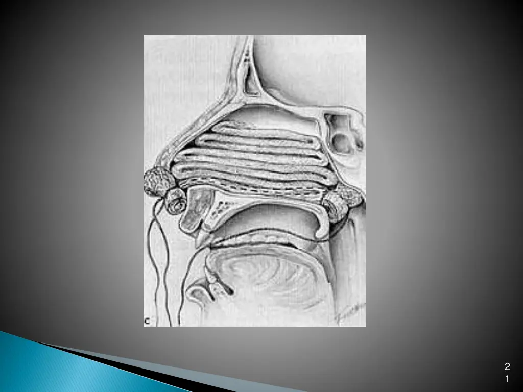 slide21