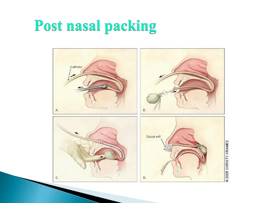 slide23