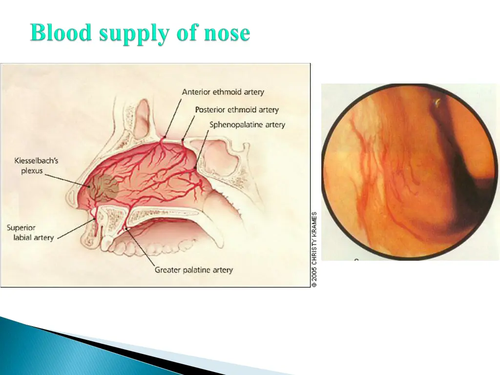 slide4