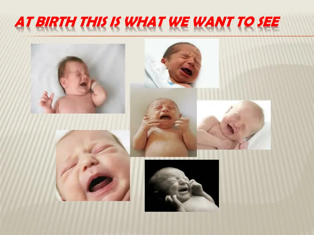 at birth this is what we want to see