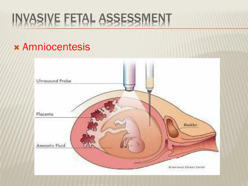 invasive fetal assessment