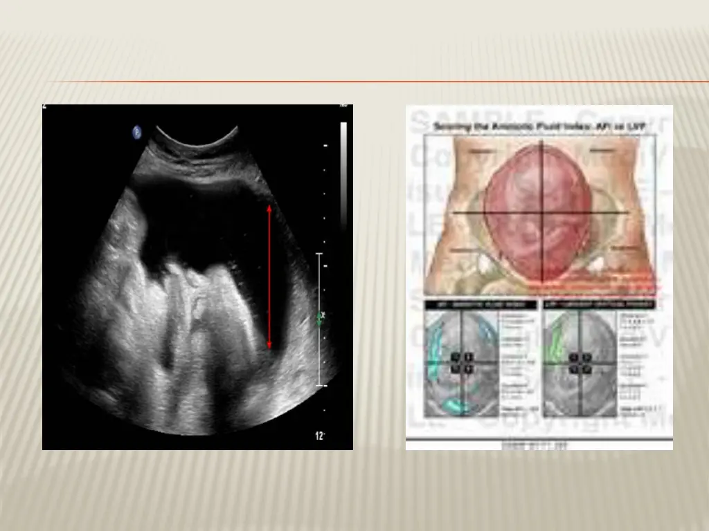 slide17