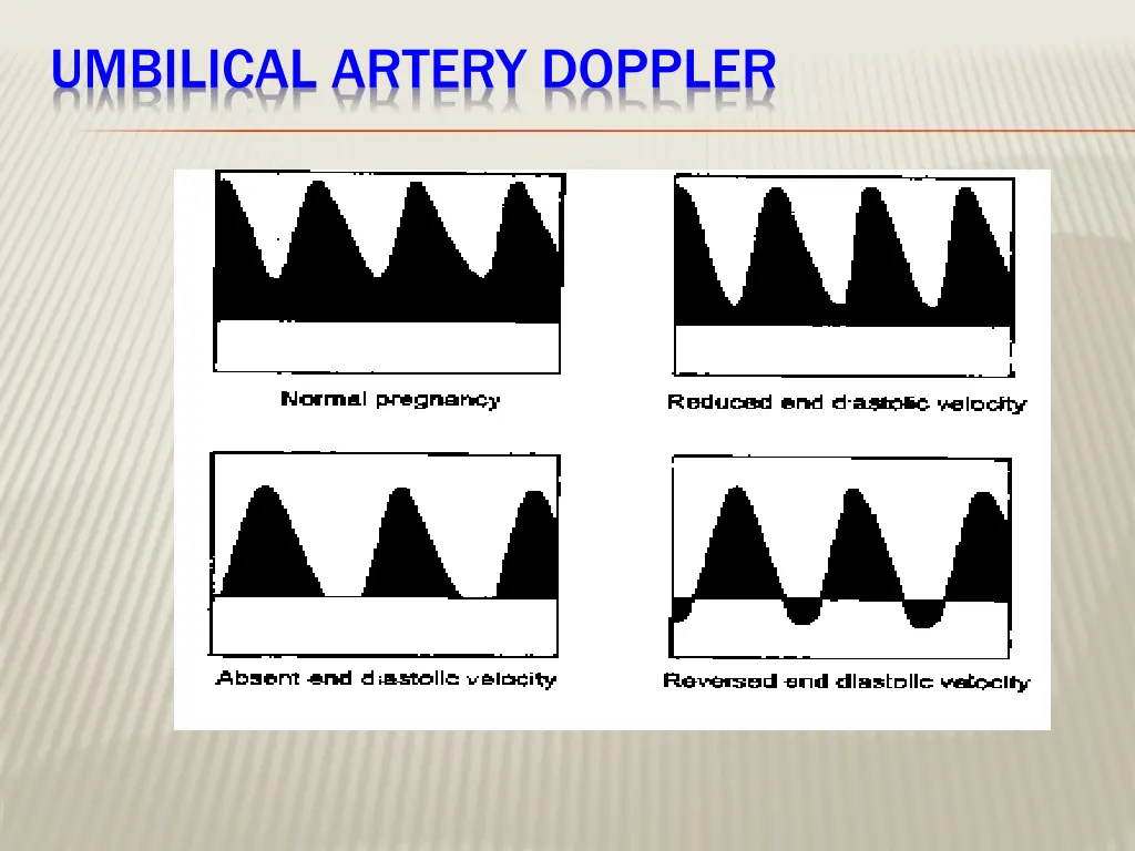 umbilical artery doppler