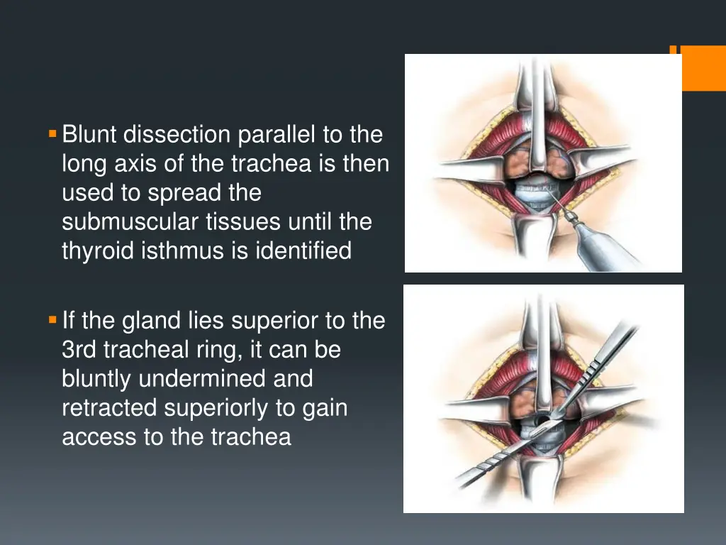 blunt dissection parallel to the long axis