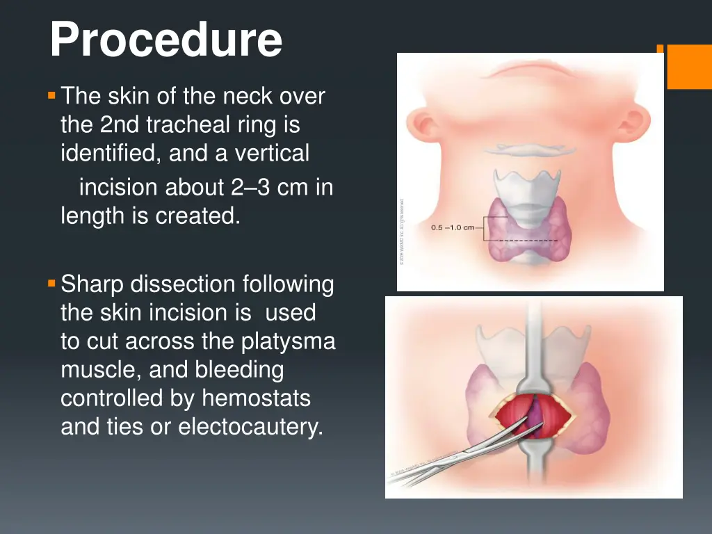 procedure