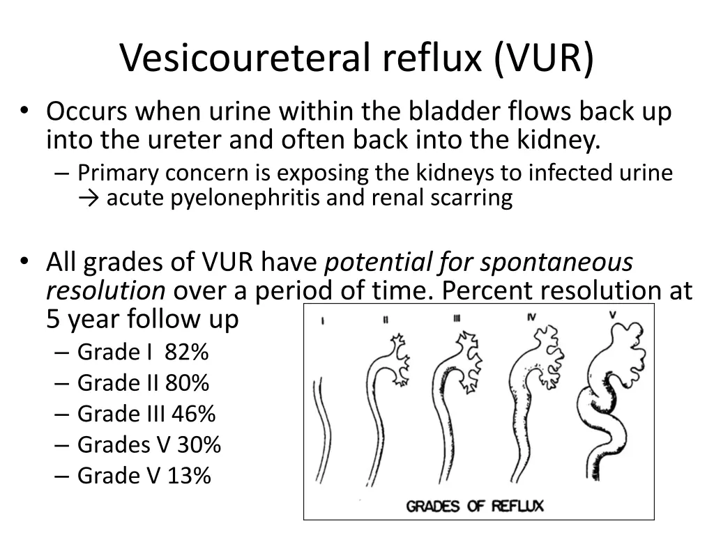 vesicoureteral reflux vur occurs when urine